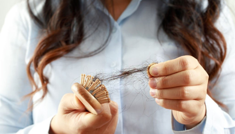 3 Main Causes of Hair Loss and How to Prevent It 1